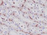 CD10 Antibody in Immunohistochemistry (Paraffin) (IHC (P))