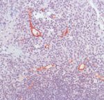 CD105 Antibody in Immunohistochemistry (IHC)