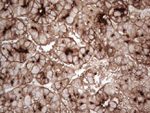 CD13 Antibody in Immunohistochemistry (Paraffin) (IHC (P))
