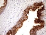 CD13 Antibody in Immunohistochemistry (Paraffin) (IHC (P))