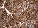 CD13 Antibody in Immunohistochemistry (Paraffin) (IHC (P))