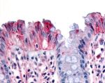 RON Antibody in Immunohistochemistry (Paraffin) (IHC (P))