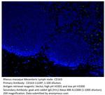 CD163 Antibody in Immunohistochemistry (IHC)
