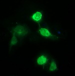 CD163 Antibody in Immunocytochemistry (ICC/IF)