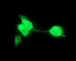 CD163 Antibody in Immunocytochemistry (ICC/IF)