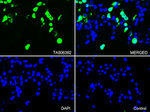 CD163 Antibody in Immunocytochemistry (ICC/IF)