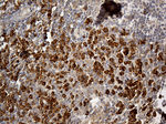 CD163 Antibody in Immunohistochemistry (Paraffin) (IHC (P))