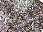 CD163 Antibody in Immunohistochemistry (Paraffin) (IHC (P))