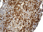CD163 Antibody in Immunohistochemistry (Paraffin) (IHC (P))