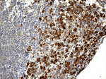 CD163 Antibody in Immunohistochemistry (Paraffin) (IHC (P))