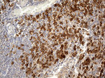 CD163 Antibody in Immunohistochemistry (Paraffin) (IHC (P))