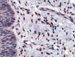 CD163 Antibody in Immunohistochemistry (IHC)