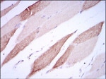 CD166 Monoclonal Antibody (5B3)