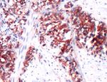 RHAMM Antibody in Immunohistochemistry (IHC)