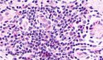 CXCR2 Antibody in Immunohistochemistry (Paraffin) (IHC (P))
