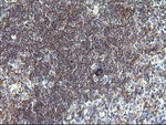 CD19 Antibody in Immunohistochemistry (Paraffin) (IHC (P))