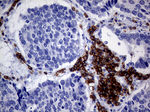 CD19 Antibody in Immunohistochemistry (Paraffin) (IHC (P))