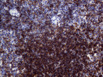 CD19 Antibody in Immunohistochemistry (Paraffin) (IHC (P))