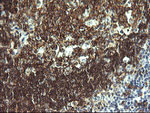 CD19 Antibody in Immunohistochemistry (Paraffin) (IHC (P))