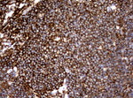 CD19 Antibody in Immunohistochemistry (Paraffin) (IHC (P))