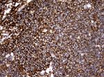 CD19 Antibody in Immunohistochemistry (Paraffin) (IHC (P))