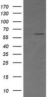 CD19 Antibody in Western Blot (WB)