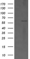 CD19 Antibody in Western Blot (WB)