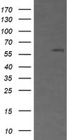 CD19 Antibody in Western Blot (WB)