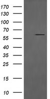 CD19 Antibody in Western Blot (WB)