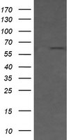 CD19 Antibody in Western Blot (WB)