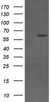 CD19 Antibody in Western Blot (WB)