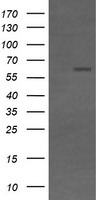 CD19 Antibody in Western Blot (WB)
