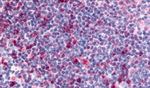 CCR3 Antibody in Immunohistochemistry (Paraffin) (IHC (P))