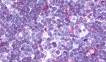 CCR9 Antibody in Immunohistochemistry (Paraffin) (IHC (P))
