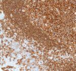 CD19 Antibody in Immunohistochemistry (Paraffin) (IHC (P))