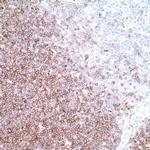 CD1a Antibody in Immunohistochemistry (IHC)