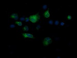 CD1C Antibody in Immunocytochemistry (ICC/IF)