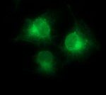 CD1C Antibody in Immunocytochemistry (ICC/IF)