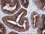 CD1C Antibody in Immunohistochemistry (Paraffin) (IHC (P))