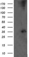 CD1C Antibody in Western Blot (WB)