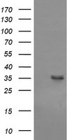 CD1C Antibody in Western Blot (WB)