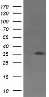 CD1C Antibody in Western Blot (WB)