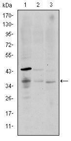 CD1a Monoclonal Antibody (6H3)