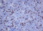 CD2 Antibody in Immunohistochemistry (Paraffin) (IHC (P))