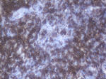 CD2 Antibody in Immunohistochemistry (Paraffin) (IHC (P))