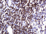 CD2 Antibody in Immunohistochemistry (Paraffin) (IHC (P))