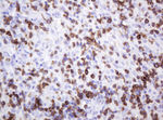 CD2 Antibody in Immunohistochemistry (Paraffin) (IHC (P))
