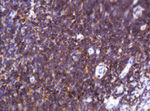 CD2 Antibody in Immunohistochemistry (Paraffin) (IHC (P))