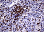 CD2 Antibody in Immunohistochemistry (Paraffin) (IHC (P))