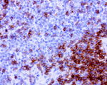 CD2 Antibody in Immunohistochemistry (Paraffin) (IHC (P))